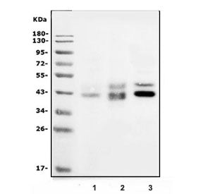 Western blot testing of human 1) K562, 2) HT1080 and 3) HepG2 lysate with DR5 antibody. Expected mol