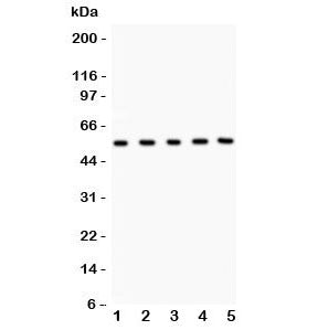 Western blot testing of MMP3 antibody and Lane 1: human placenta; 2: U20S; 3: HeLa; 4: PANC; 5: COLO