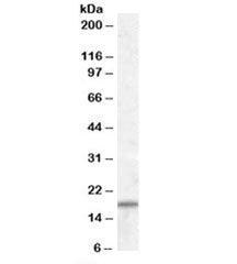 Western blot testing of human skeletal muscle lysate with COX4I2 antibody at 1ug/ml. Predicted molec