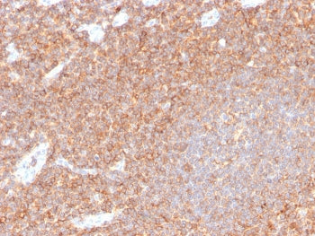 IHC staining of FFPE human tonsil with recombinant CD44 antibody (clone HCAM/4110R). HIER: boil tiss
