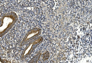IHC staining of FFPE human appendicitis tissue with gp91phox antibody. HIER: boil tissue sections in