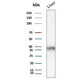 ARK1C1 Antibody / Aldo-keto Reductase Family 1 Member C1