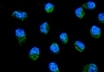 MT-ND6 Antibody / NADH dehydrogenase subunit 6