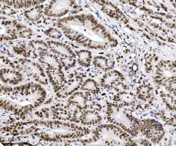 TIF1 alpha Antibody / TIF1A / TRIM24