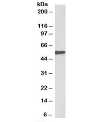 EPHX2Antibody