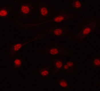 Immunofluorescent staining of FFPE human A549 cells with PRPF6 antibody. HIER: steam section in pH6 