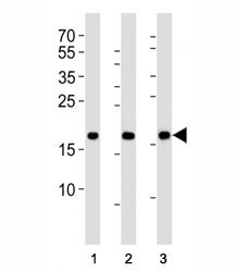 Western blot analysis of lysate from HepG2, NCCIT, mouse NIH3T3 cell line (left to right) using HMGA