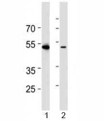 Western blot analysis of lysate from 1) HL-60 and 2) Jurkat cell line using RUNX3 antibody at 1:1000