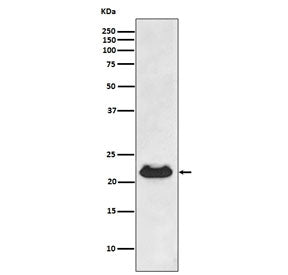 Western blot testing of human fetal heart lysate with Alpha B Crystallin antibody. Predicted molecul