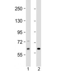 EPHX2 Antibody / Epoxide hydrolase 2
