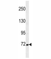 Cortactin Antibody