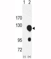 ROR2 Antibody