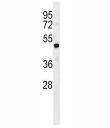 FEZF2 Antibody