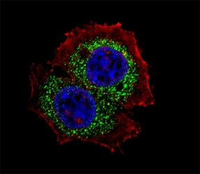 Estrogen Receptor Antibody (alpha, isoform 4)