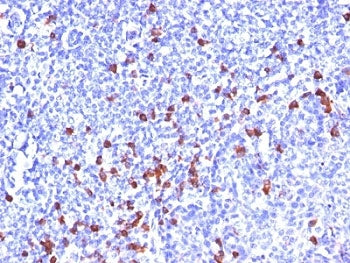 IgG Heavy Chain Antibody
