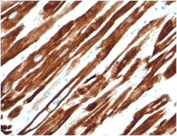 IHC testing of FFPE human uterus with recombinant Desmin antibody (clone rDES/1711). Required HIER: 