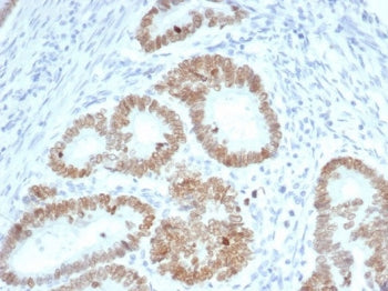 SATB2 Antibody