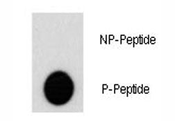 Phospho-AKT2 Antibody (pS474)