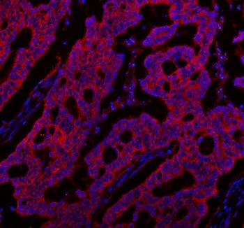NKCC1 Antibody SLC12A2