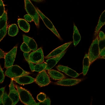 ZNF622 Antibody / ZPR9