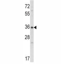 Western blot analysis of Connective Tissue Growth Factor antibody and NCI-H460 lysate. Predicted molecular weight ~38kDa.