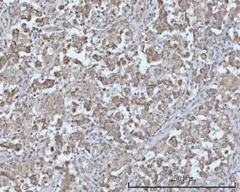 BCAP Antibody / Basal body centriole-associated protein / ODF2L