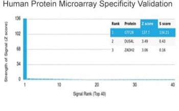 TFIIB Antibody / GTF2B