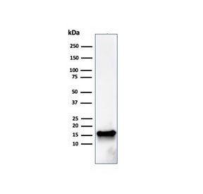 FABP5 Antibody (epidermal)