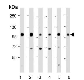 IGF1R Antibody / Insulin like growth factor 1 receptor
