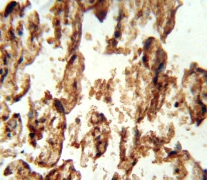 IGFBP4 Antibody