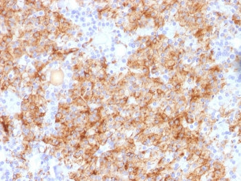 IHC staining of FFPE human parathyroid gland with Chromogranin A antibody. HIER: boil tissue section