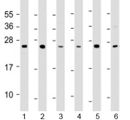 TPD52 Antibody / Tumor protein D52