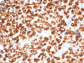 Tryptophan Hydroxylase Antibody / TPH1