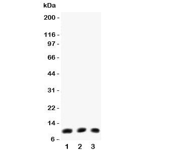 Western blot testing of Eotaxin antibody (0.5ug/ml) and Lane 1: mouse lung; 2: (m) intestine; 3: (m)