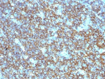 IHC testing of CD20 antibody and FFPE human tonsil tissue. Required HIER: steam section in pH6 citra