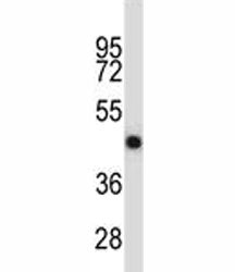 Osteoprotegerin Antibody (OPG)