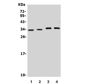 Neurotrophin 3 Antibody / NTF3