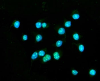 Immunofluorescent staining of FFPE human MCF7 cells with CENPB antibody (green) and DAPI nuclear sta
