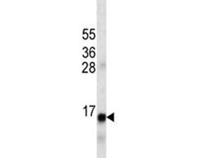 Insulin Antibody