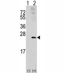 RAC1 Antibody