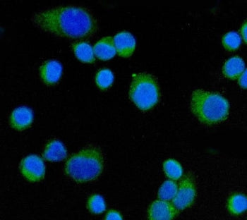 Immunofluorescent staining of FFPE human SiHa cells with CD55 antibody (green) and DAPI nuclear stai