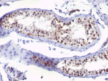 Thymidylate Synthase Antibody