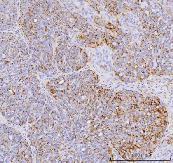 YB1 Antibody