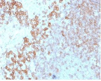 IHC staining of FFPE human tonsil tissue with CD27 antibody (clone LPFS2/4178). HIER: boil tissue se