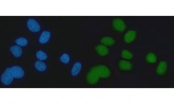 Immunofluorescent staining of FFPE human MCF7 cells with EXO1 antibody (green) and DAPI nuclear stai