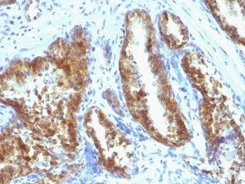 PSA / Prostate Specific Antigen Antibody