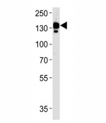 Ceruloplasmin antibody western blot analysis in human blood plasma lysate. Predicted molecular weigh