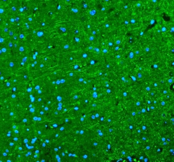 Immunofluorescent staining of FFPE mouse brain tissue with Alpha Internexin antibody (green) and DAP