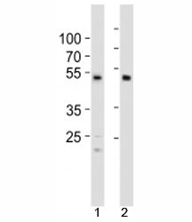 Western blot analysis of lysate from 1) HCT116 cell line and 2) human heart tissue using SOX7 antibo