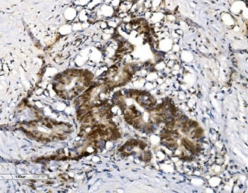 VPRBP Antibody / DCAF1
